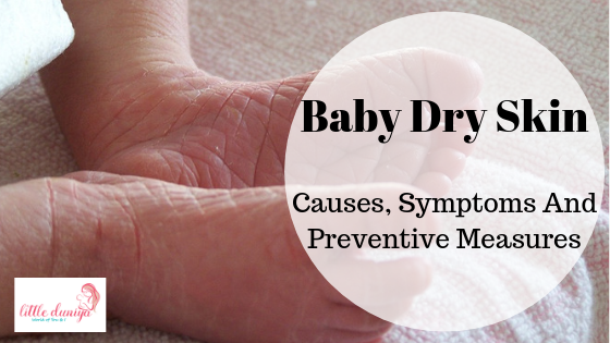 Baby Dry Skin, Baby Dry Skin Best Lotion, Baby Dry Skin Soap, Baby Dry Skin Lotion